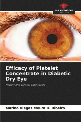 Efficacy of Platelet Concentrate in Diabetic Dry Eye 1