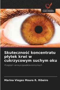 bokomslag Skuteczno&#347;c koncentratu plytek krwi w cukrzycowym suchym oku