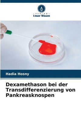 bokomslag Dexamethason bei der Transdifferenzierung von Pankreasknospen