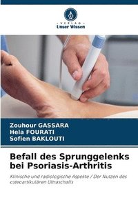 bokomslag Befall des Sprunggelenks bei Psoriasis-Arthritis