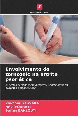 bokomslag Envolvimento do tornozelo na artrite psoriática