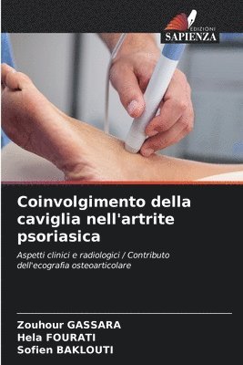 bokomslag Coinvolgimento della caviglia nell'artrite psoriasica