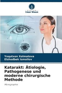 bokomslag Katarakt: Ätiologie, Pathogenese und moderne chirurgische Methode