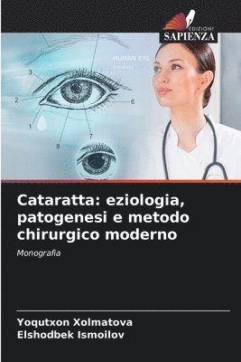 Cataratta: eziologia, patogenesi e metodo chirurgico moderno 1