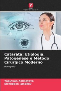 bokomslag Catarata: Etiologia, Patogénese e Método Cirúrgico Moderno