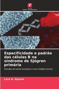 bokomslag Especificidade e padrão das células B na síndrome de Sjögren primária