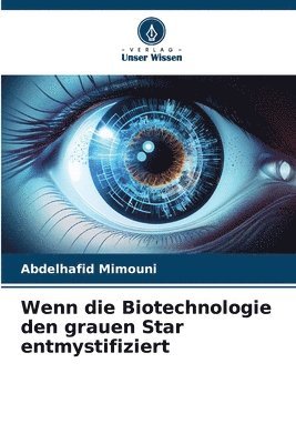 bokomslag Wenn die Biotechnologie den grauen Star entmystifiziert