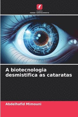 A biotecnologia desmistifica as cataratas 1