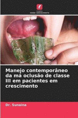 Sunaina, Dr. Sunaina - Manejo contemporâneo da má oclusão de classe III em pacientes em crescimento, Häftad