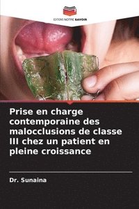 bokomslag Prise en charge contemporaine des malocclusions de classe III chez un patient en pleine croissance