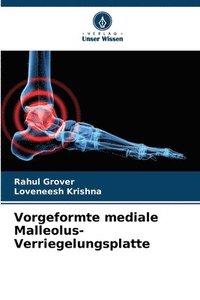 bokomslag Vorgeformte mediale Malleolus-Verriegelungsplatte