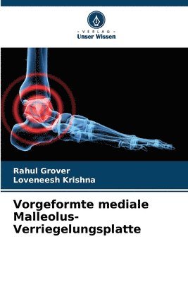 Vorgeformte mediale Malleolus-Verriegelungsplatte 1