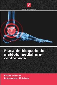 bokomslag Placa de bloqueio do maléolo medial pré-contornada