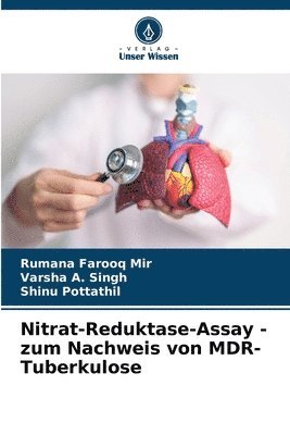 Nitrat-Reduktase-Assay - zum Nachweis von MDR-Tuberkulose 1