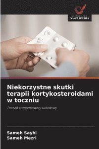 bokomslag Niekorzystne skutki terapii kortykosteroidami w toczniu