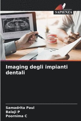 bokomslag Imaging degli impianti dentali