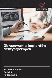 bokomslag Obrazowanie implantów dentystycznych