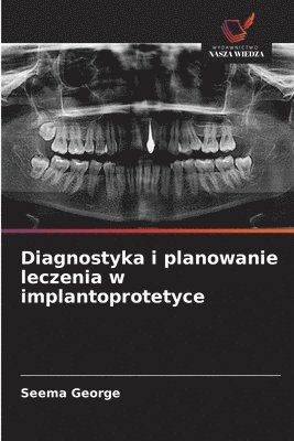 bokomslag Diagnostyka i planowanie leczenia w implantoprotetyce