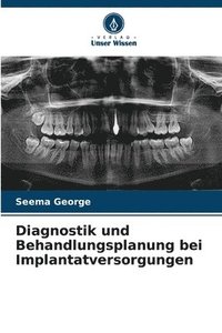 bokomslag Diagnostik und Behandlungsplanung bei Implantatversorgungen