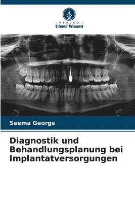 bokomslag Diagnostik und Behandlungsplanung bei Implantatversorgungen