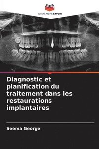 bokomslag Diagnostic et planification du traitement dans les restaurations implantaires