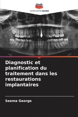 Diagnostic et planification du traitement dans les restaurations implantaires 1