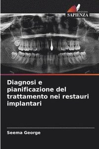 bokomslag Diagnosi e pianificazione del trattamento nei restauri implantari