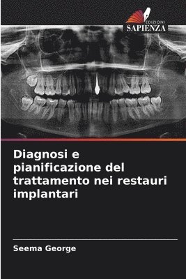 bokomslag Diagnosi e pianificazione del trattamento nei restauri implantari