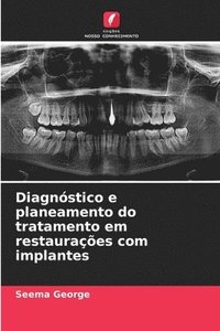 bokomslag Diagnóstico e planeamento do tratamento em restaurações com implantes