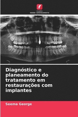 bokomslag Diagnstico e planeamento do tratamento em restauraes com implantes