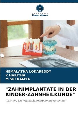 bokomslag &quot;Zahnimplantate in Der Kinder-Zahnheilkunde&quot;