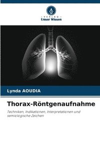 bokomslag Thorax-Röntgenaufnahme