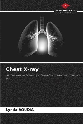 bokomslag Chest X-ray