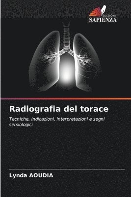 Radiografia del torace 1