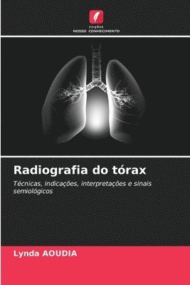 bokomslag Radiografia do trax