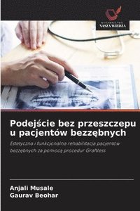 bokomslag Podej&#347;cie bez przeszczepu u pacjentów bezz&#281;bnych