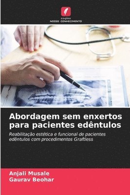 bokomslag Abordagem sem enxertos para pacientes edntulos