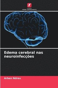 bokomslag Edema cerebral nas neuroinfecções