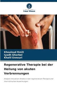 bokomslag Regenerative Therapie bei der Heilung von akuten Verbrennungen