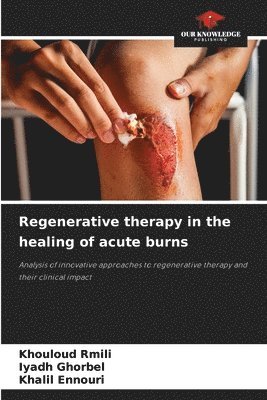 bokomslag Regenerative therapy in the healing of acute burns