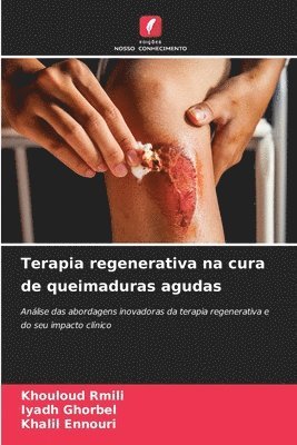 bokomslag Terapia regenerativa na cura de queimaduras agudas