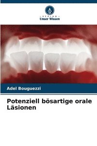 bokomslag Potenziell bösartige orale Läsionen