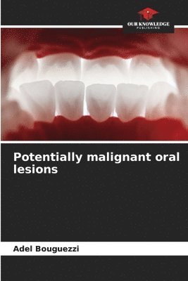 bokomslag Potentially malignant oral lesions