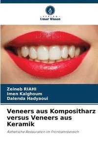 bokomslag Veneers aus Kompositharz versus Veneers aus Keramik