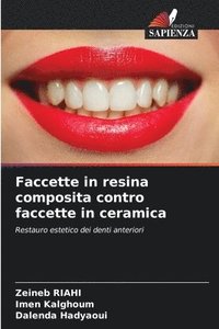 bokomslag Faccette in resina composita contro faccette in ceramica