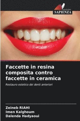 Faccette in resina composita contro faccette in ceramica 1