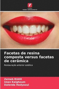 bokomslag Facetas de resina composta versus facetas de cermica