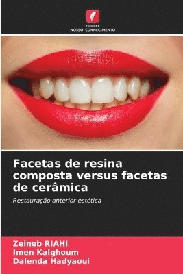 Facetas de resina composta versus facetas de cermica 1