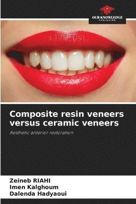 bokomslag Composite resin veneers versus ceramic veneers