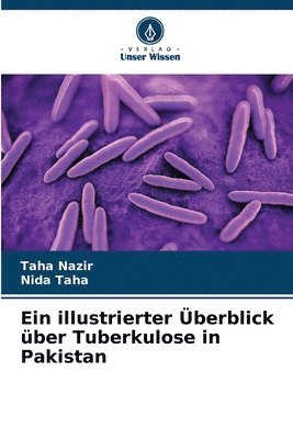 bokomslag illustrierter Überblick über Tuberkulose in Pakistan